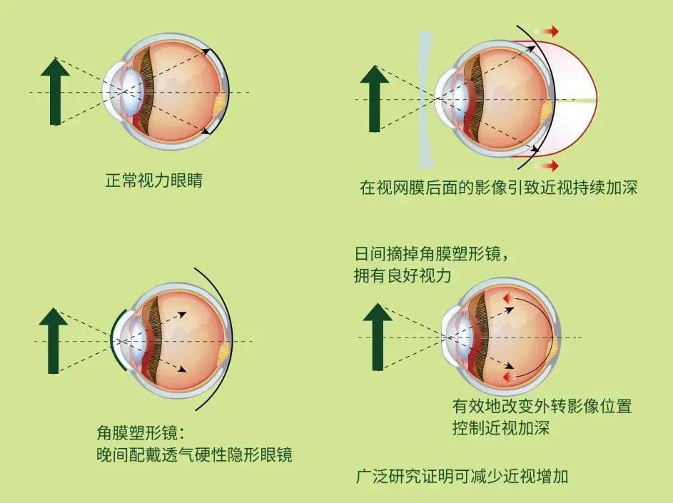 ”王者承诺 第5页